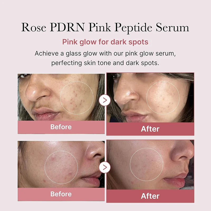 Korean Peptide Collagen Serum Essence for Radiant Skin & Deep Hydration